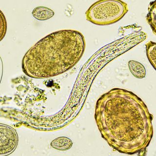 Eliminazione Sicura dei Parassiti 